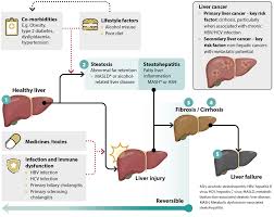 Image result for Liver Function Test
