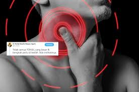 Cara merawat tanaman yang kedua setelah memberikan air adalah dengan mengekspos tanaman pada sinar matahari. Jangkitan Tonsil Adakah Wajib Ambil Antibiotik Atau Perlu Dibedah Doktor Ini Ada Jawapannya Lifestyle Rojak Daily