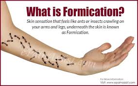 What Is Formication Fibromyalgia Medical Feelings