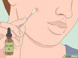 How To Get Rid Of A Zit Overnight (With Pictures) - Wikihow