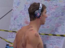 Michael phelps was suspended for three months in 2009 by usa swimming after a photograph emerged that showed him smoking marijuana. Olympian Michael Phelps Has Circle Marks From Cupping Therapy Benefits