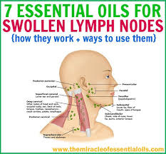 Pin On Essential Oils