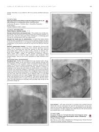 A fire broke out at sultanah aminah hospital in johor baru june 28, 2020. Pdf Tctap C 046 Successful Wiring Of A Critically Narrowed Ostial Diagonal Lesion Assisted By A Double Lumen Microcatheter When Conventional Wiring Techniques Failed