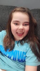 Hello everyone, I want to consult and ask for help. Our baby is 2.5 years  old, and we recommend starting to take Daybue, now we do not have an  epileptic seizures, and