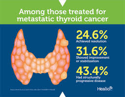 It is difficult to be very specific without having more detailed information. Patients With Metastatic Thyroid Cancer Frequently Achieve Good Long Term Outcomes