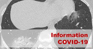 Un scanner thoracique sans injection d'iode peut être prescrit devant : La Societe D Imagerie Thoracique Propose Un Compte Rendu Structure De Scanner Thoracique Pour Les Patients Suspects De Covid 19 Sfr E Bulletin