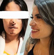 Instagram photo by Dra. Michelle Simas • Jul 13, 2025 at 4:54 PM