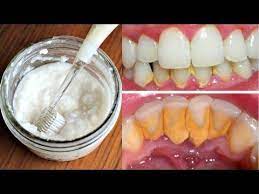 Pin On Teeth Problem