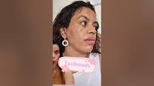 DUO QUITA MANCHAS CALENDULA