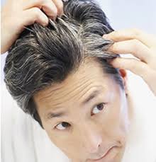 That is where foods to prevent white hair come in. White Hair Archives Homeopathy At Drhomeo Com