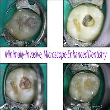 Check spelling or type a new query. Do Teeth With Root Canals Need Crowns