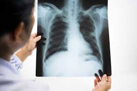 Orpi vous présente toutes les informations indispensables pour investir dans l'achat et la location d'un. Radiologie Paris Imagerie 114 Paris