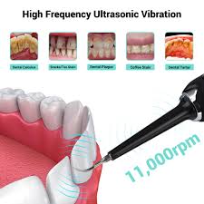 Maybe you would like to learn more about one of these? Electric Toothbrush Teeth Calculus Remover Sonic Dental Scaler Tooth Stains Tartar Dentist Teeth Whitening Oral Irrigator Teeth Whitening Aliexpress