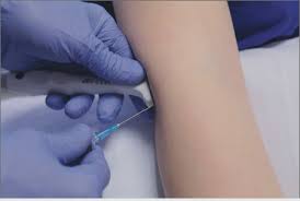 Image result for Elbow Joint Injection