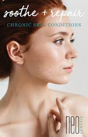 CHRONIC SKIN CONDITIONS