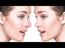 How To Reshape Your Sagging Nose And Give Yourself A Nose Lift Facerobics Youtube Rhinoplasty Nose Surgery Nose Job