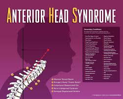 Anterior Head Syndrome Chiropractic Neurological System Melt Method
