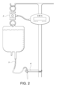 Image result for Bladder Irrigation