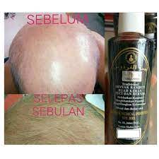 Check spelling or type a new query. Minyak Lebat Rambut Buah Keras 85 Ml Mengatasi Masalah Rambut Shopee Malaysia