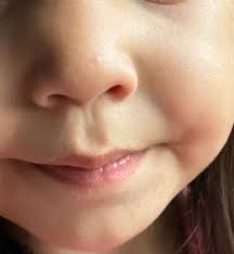 my daughter has this black spot nose recently popped out. Should i worried?  any ideas?