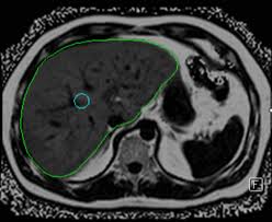 Magnetresonanztomographie Mrt Kernspintomographie Die Radiologie Munchen