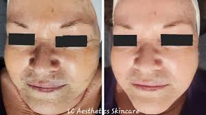 LC Aesthetics Skincare