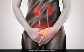 Home Remedies For Utis Women S Urine May Contain Good And Bad Bacteria And This Could Help With Uti Treatment