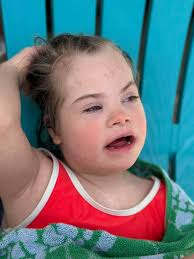 Glory is profoundly deaf in both ears