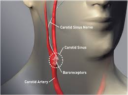 The external carotid artery travels more closely to the surface, and sends off numerous branches that supply the neck and face. Fda Approves Pacemaker Like Device To Treat Heart Failure Daic