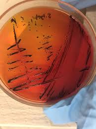 A number of its serovars are serious human pathogens. Salmonella Enterica Ser Typhimurium Free Download Borrow And Streaming Internet Archive