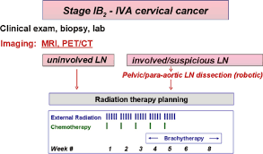 A total hysterectomy is the most common treatment for women with stage 1 cervical cancer who do. Diagram Of The Treatment Algorithm For Cervical Cancer Showing The Download Scientific Diagram