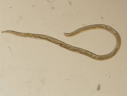 Meet The Menagerie Of Parasites That Can Live In Human Eyes Popular Science