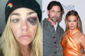 Denise Richards Accuses Aaron Phypers of Domestic Violence, Granted  Temporary Restraining Order