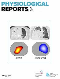 Image result for Ventilation Perfusion Scan