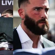 Canelo' le rompe la cara a Plank: Saúl Álvarez revela porque golpeó a Caleb  en rueda de prensa