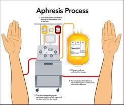 Image result for Apheresis