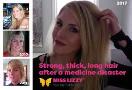 If you're not, you should be! Pin On Hypothyroid Before And After Photos