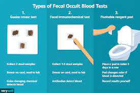 The fecal occult blood test (fobt) is a simple, inexpensive and most frequently performed chemical screening test on feces. Fecal Occult Blood Test Fobt Uses Procedure Results