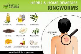 Home Remedies For Ringworms Home Remedies For Ringworm Ringworm Remedies Home Remedies