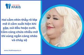 Tướng mặt hai cằm Nam, nữ