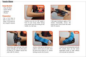 Taping for tennis elbow isn't always the right answer. Tennis Elbow Genesis