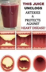 What drinks are good for the heart? This Juice Unclogs Arteries Protects Against Heart Disease Unclog Arteries Arteries Foods For Healthy Skin