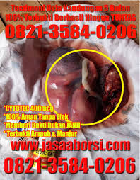 Hanya uang di tangan, tanpa anak tanpa pria yang ia cintai karena terbiasa. Harga Pil Menggugurkan Kandungan 0821 3584 0206 Bisa Bayar Di Tempat Cod Ahrecs