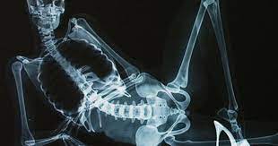 XXX X-Ray Pictures: Naked Anatomy Lesson Shocks Senses - CBS News
