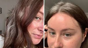 Woman embraces her grey hair in her twenties after getting first silver  streaks at 15