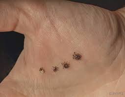 Sous la peau est un roman trash, évidemment à ne pas mettre entre toutes les mains, qui traite d'un double univers extrême. 6 Conseils Pour Eviter Les Mechantes Tiques Ciusss Mcq