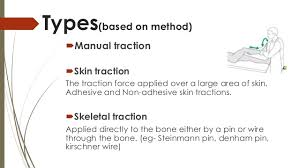 Traction Orthopedics