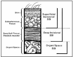 As its name suggests, an ssi/ssd psychological exam is essentially a mental consultative test that will allow professional examiners to better understand your condition. Https Spice Unc Edu Wp Content Uploads 2017 05 10 Ssi 2017 Handouts Pdf