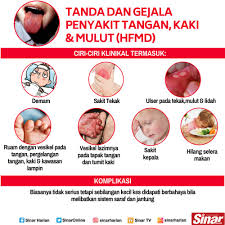 Biasanya terdapat di atas lidah, gusi dan di sebelah dalam pipi. Sinaronline Twitterissa Tanda Dan Gejala Penyakit Tangan Kaki Dan Mulut Hfmd