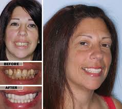 Oral and maxillofacial surgery is also referred to as oral surgery and sometimes dentoalveolar surgery. Oral Surgery Top Rated Maxillofacial Surgeon In Brooklyn